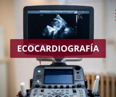 ecocardiografía